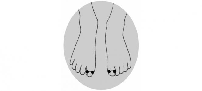 acupression pied